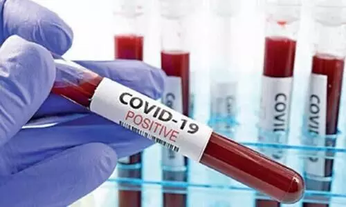 കോഴിക്കോട്​ ജില്ലയിലെ കോവിഡ് പരിശോധന രണ്ടുലക്ഷം പിന്നിട്ടു