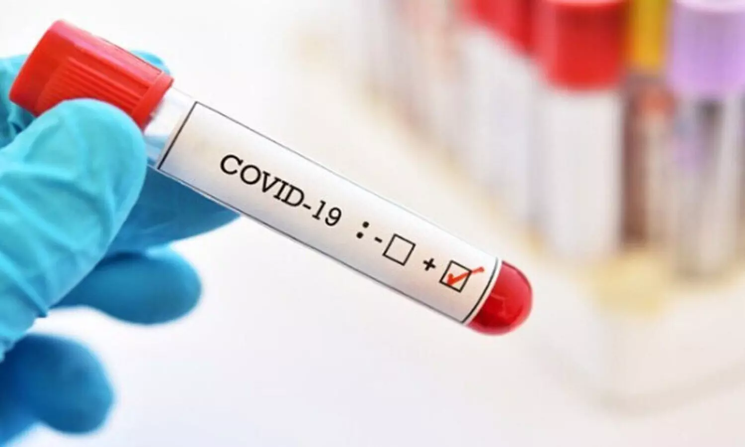 ലോകത്ത്​ കോവിഡ്​ ബാധിതർ 99 ലക്ഷം കടന്നു