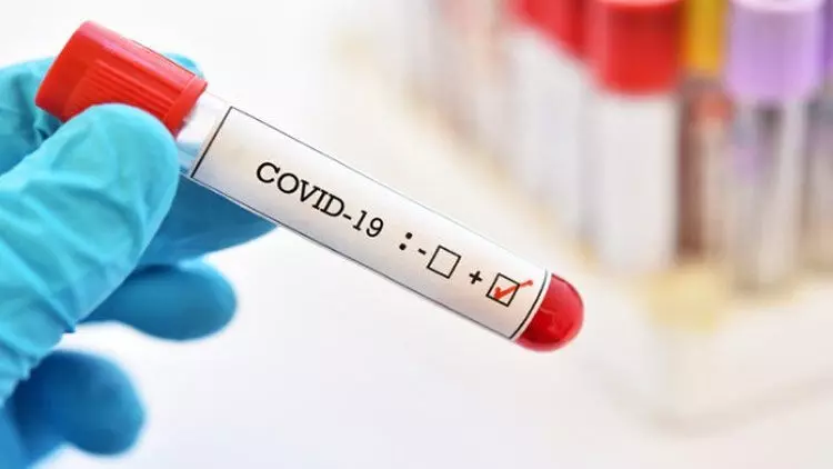 ലോകത്ത് കോവിഡ് ബാധിതർ 99 ലക്ഷം കടന്നു ലോകത്ത് കോവിഡ് ബാധിതർ 99 ലക്ഷം കടന്നു