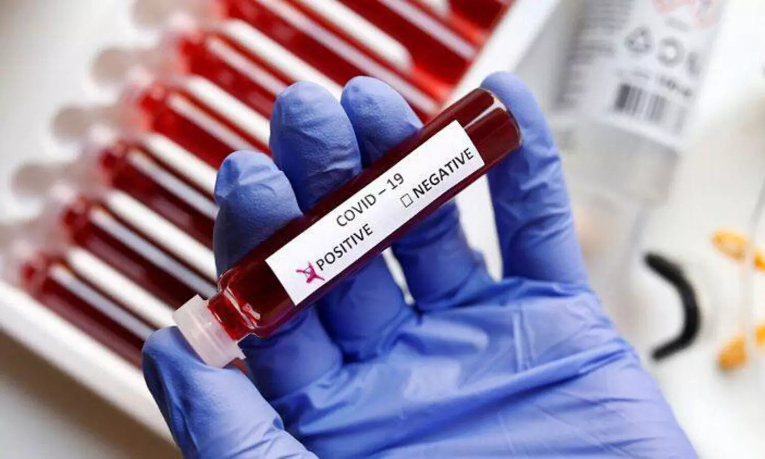 തൂങ്ങിമരിച്ചയാൾക്ക് കോവിഡ്; കോഴിക്കോട്ട് ഏഴ് പൊലീസുകാർ ക്വാറന്‍റീനിൽ