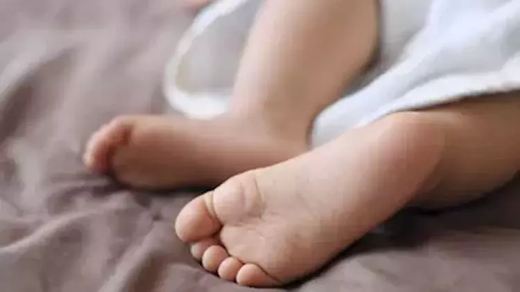 രോഗം ഭേദമാകാൻ മാതാവ്​ ദേഹത്ത്​ ഇരുമ്പ്​ പഴുപ്പിച്ച്​ വെച്ച പിഞ്ചുകുഞ്ഞ്​ മരിച്ചു