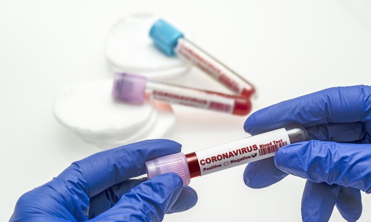 കോവിഡ്: സൗദി അറേബ്യയിൽ 816 പുതിയ കേസുകളും 27 മരണവും