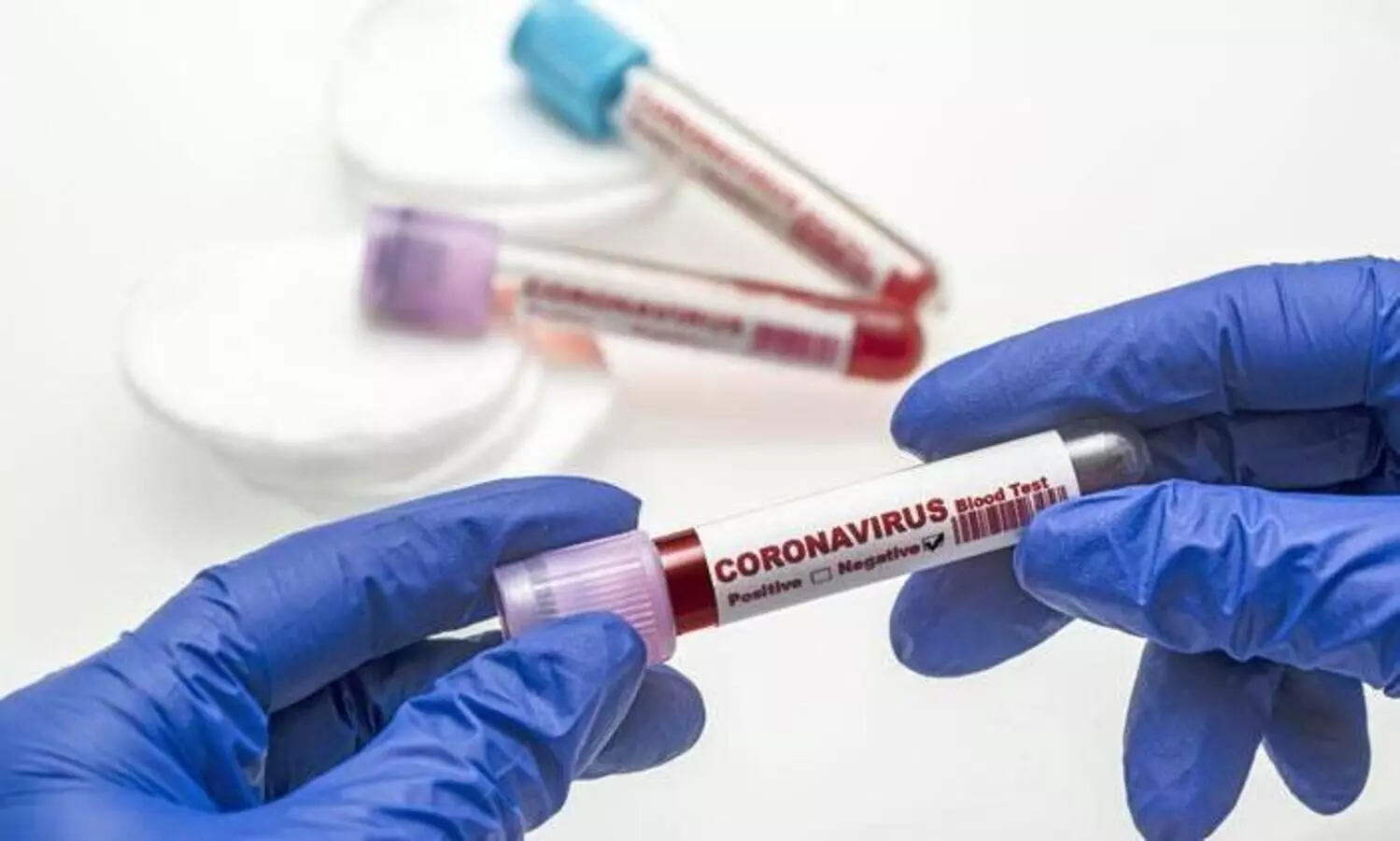 സൗദി അറേബ്യയിൽ കോവിഡ്​ ആശങ്കയൊഴിയുന്നു