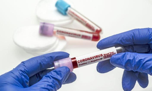 സൗദി അറേബ്യയിൽ കോവിഡ്​ ആശങ്കയൊഴിയുന്നു