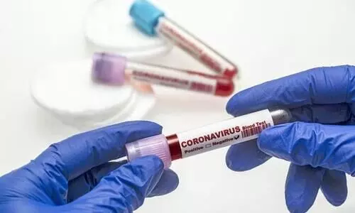 സൗദി അറേബ്യയിൽ കോവിഡ്​ ആശങ്കയൊഴിയുന്നു