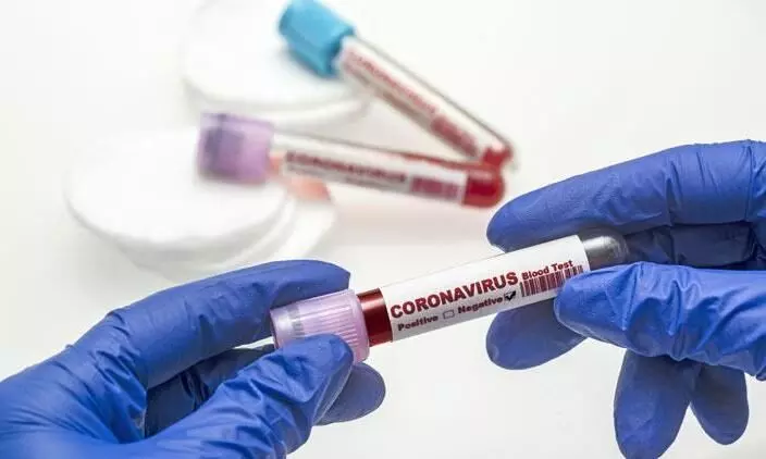 സൗദി അറേബ്യയിൽ കോവിഡ് ആശങ്കയൊഴിയുന്നു സൗദി അറേബ്യയിൽ കോവിഡ് ആശങ്കയൊഴിയുന്നു