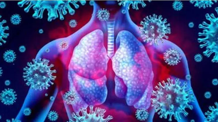 സംസ്ഥാനത്ത് ഇന്ന് 1129 പേര്ക്ക് കോവിഡ്; 880 പേര്ക്ക് സമ്പര്ക്കം സംസ്ഥാനത്ത് ഇന്ന് 1129 പേര്ക്ക് കോവിഡ്; 880 പേര്ക്ക് സമ്പര്ക്കം