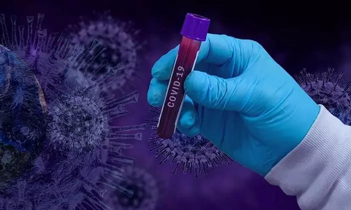 യു.കെയിൽ കോവിഡ് മരണം 46,000 കടന്നു യു.കെയിൽ കോവിഡ് മരണം 46,000 കടന്നു