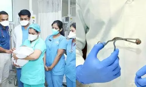 റംബുട്ടാന്‍ ശ്വാസനാളത്തില്‍ കുടുങ്ങിയ കുഞ്ഞിന് പുതുജീവൻ 