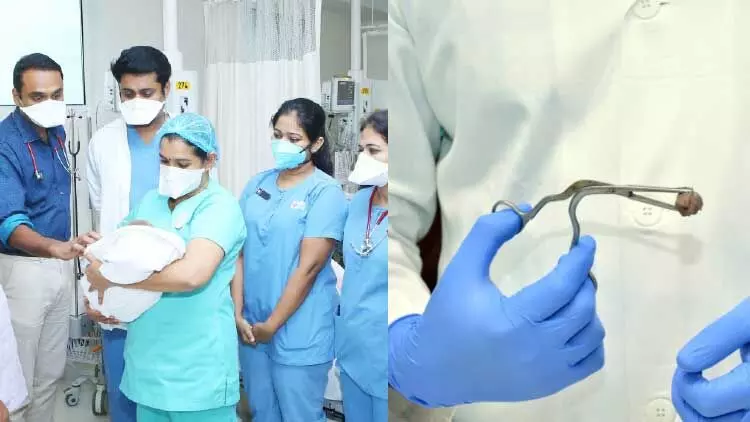 റംബുട്ടാന്‍ ശ്വാസനാളത്തില്‍ കുടുങ്ങിയ കുഞ്ഞിന് പുതുജീവൻ 