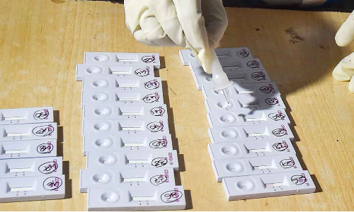 കോവിഡ്​ പരിശോധന