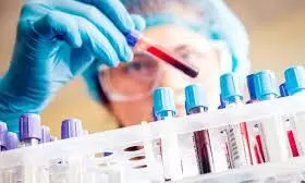 മോഷണകേസിലെ പ്രതിക്ക് കോവിഡ്; പൊലീസുകാർ നിരീക്ഷണത്തിൽ