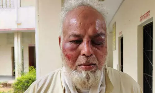 ജയ് ശ്രീ റാം വിളിക്കാത്തതിന്​ ഒാ​േട്ടാ ​ ഡ്രൈവർക്ക്​ ക്രൂരമർദനം; പല്ലുകൾ അടിച്ചുകൊഴിച്ചു