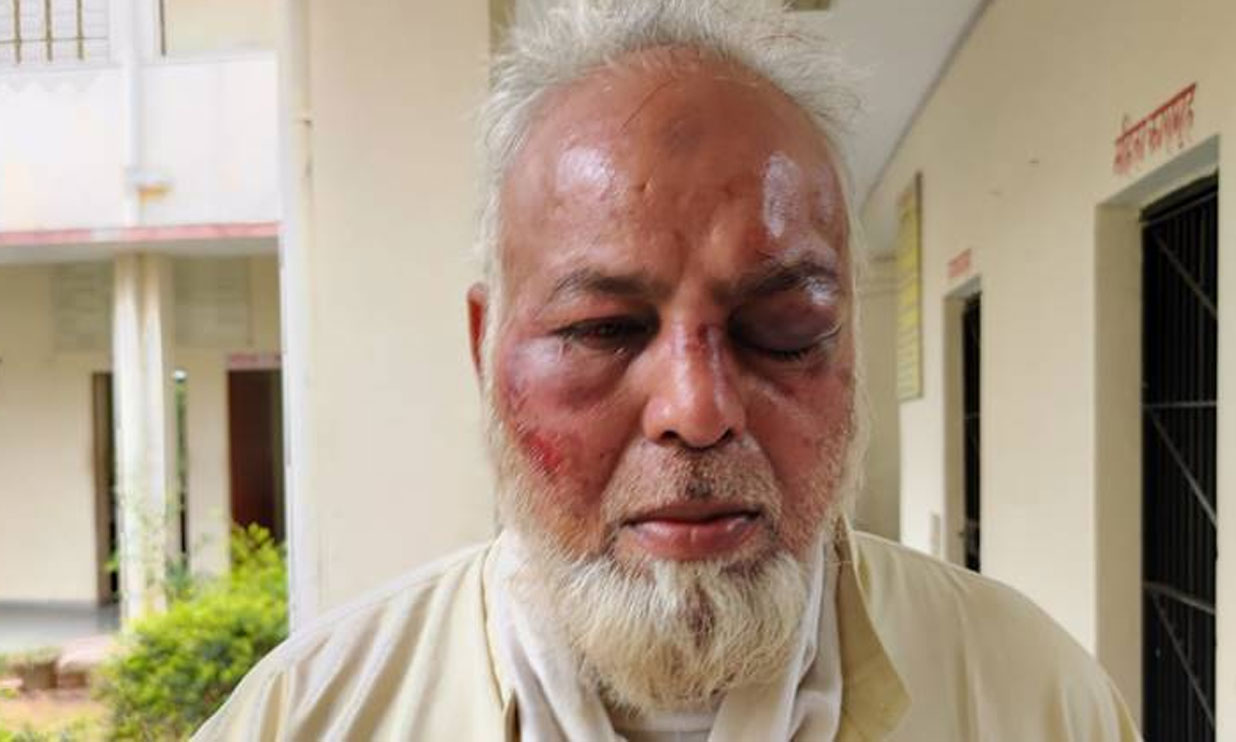 ജയ് ശ്രീ റാം വിളിക്കാത്തതിന്​ ഒാ​േട്ടാ ​ ഡ്രൈവർക്ക്​ ക്രൂരമർദനം; പല്ലുകൾ അടിച്ചുകൊഴിച്ചു