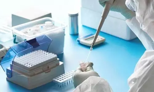 വയനാട്ടിൽ 25പേര്‍ക്ക് കോവിഡ്; എല്ലാവര്‍ക്കും സമ്പര്‍ക്കത്തിലൂടെ