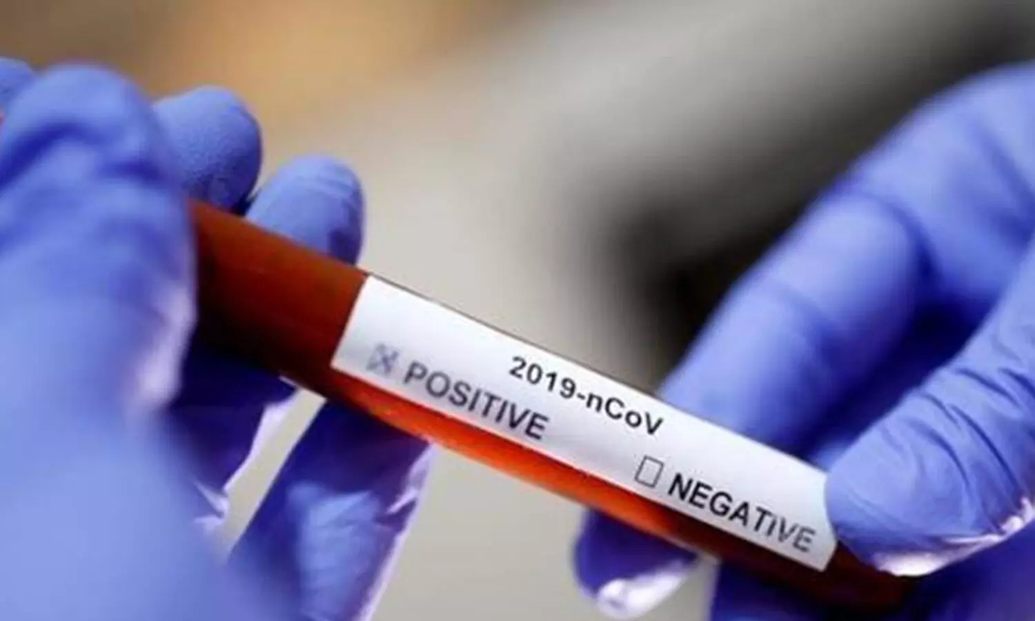 മാവൂരിൽ മരിച്ച സ്ഥാനാർഥിക്ക് കോവിഡ് സ്​ഥിരീകരിച്ചു