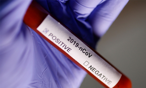 പൊതുപ്രവർത്തകന്​​ കോവിഡ്​; കാളമ്പാറയിൽ 200ഓളം പേർ ക്വാറൻറീനിൽ