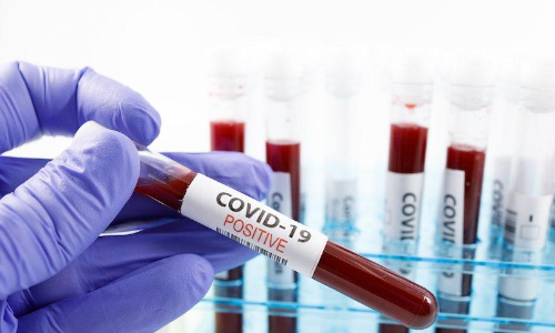 ഒമാനിൽ സ്വകാര്യ ആശുപത്രികളിലെ കോവിഡ് പരിശോധന: നിരക്കുകൾ അറിയാം ഒമാനിൽ സ്വകാര്യ ആശുപത്രികളിലെ കോവിഡ് പരിശോധന: നിരക്കുകൾ അറിയാം