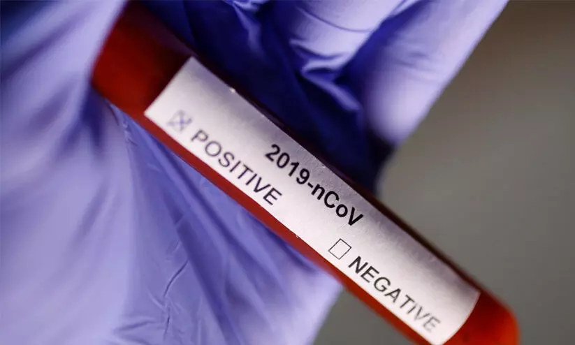 പൊതുപ്രവർത്തകന്​​ കോവിഡ്​; കാളമ്പാറയിൽ 200ഓളം പേർ ക്വാറൻറീനിൽ