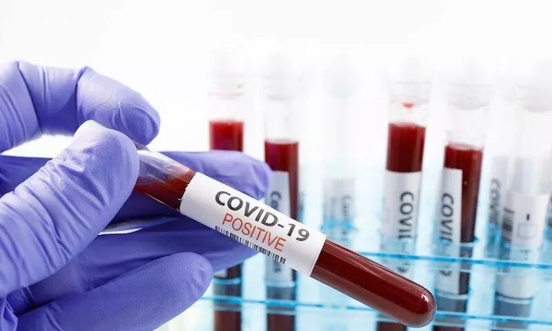 അയിരൂരിൽ പോക്​സോ പ്രതിക്ക് കോവിഡ്