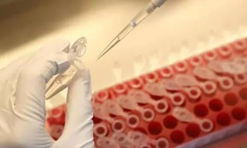 കോവിഡ് വാക്സിൻ: റഷ്യയുടെ അവകാശവാദം യാഥാർഥ്യമോ? സംശയങ്ങൾ ബാക്കിയാണ്