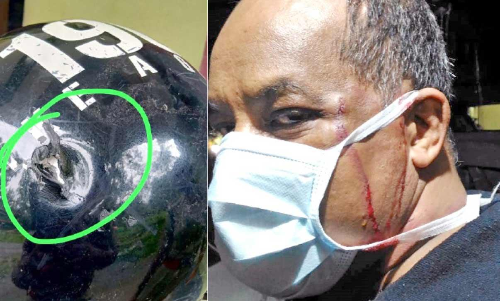 കടുവയുമായി മൽപിടിത്തം; ജീവൻ തിരിച്ചു കിട്ടിയത്​ തലനാരിഴക്ക്​