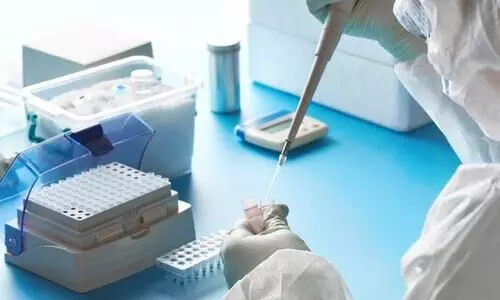 വയനാട്ടില്‍ 27 പേര്‍ക്ക് കൂടി കോവിഡ്; എല്ലാവര്‍ക്കും സമ്പര്‍ക്കത്തിലൂടെ