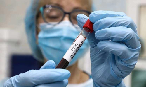 സംസ്ഥാനത്ത് മൂന്ന് കോവിഡ് മരണം