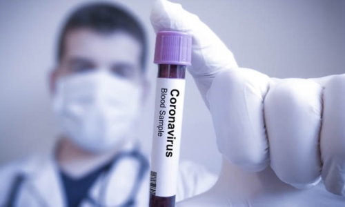 തൃശൂർ ജില്ലയിൽ 80 പേർക്ക് കൂടി കോവിഡ്; 53 പേർക്ക് രോഗമുക്തി