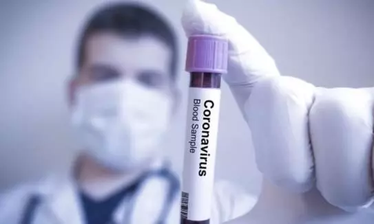 ഒമാനിൽ 212 പേർക്ക് കൂടി കോവിഡ് ഒമാനിൽ 212 പേർക്ക് കൂടി കോവിഡ്