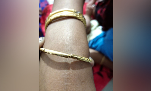 ഉറങ്ങിക്കിടന്ന യുവതിയുടെ വള കവർന്നു