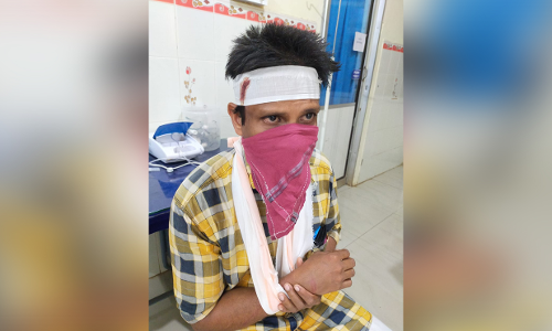 കോവിഡിൻ്റെ മറവിൽ പോലീസ് രാജ്; യുവാവിനെ മർദ്ദിച്ചതിൽ പ്രതിഷേധം