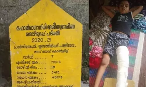 ശിലാഫലകം മറിഞ്ഞു വീണ്​ അഞ്ചു വയസുകാര​െൻറ തുടയെല്ല്​ പൊട്ടി