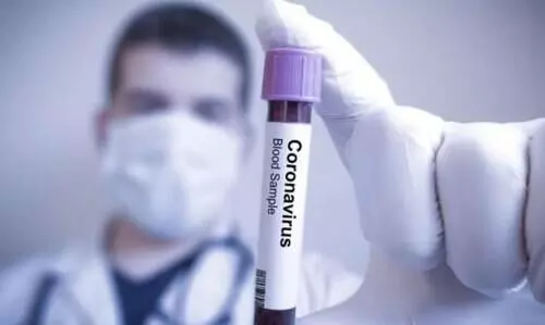 കോവിഡ്​: കോഴിക്കോട്ട്​ അഞ്ചു​ പേർ കൂടി മരിച്ചു