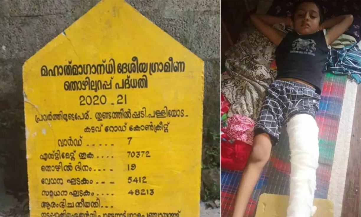ശിലാഫലകം മറിഞ്ഞു വീണ്​ അഞ്ചു വയസുകാര​െൻറ തുടയെല്ല്​ പൊട്ടി