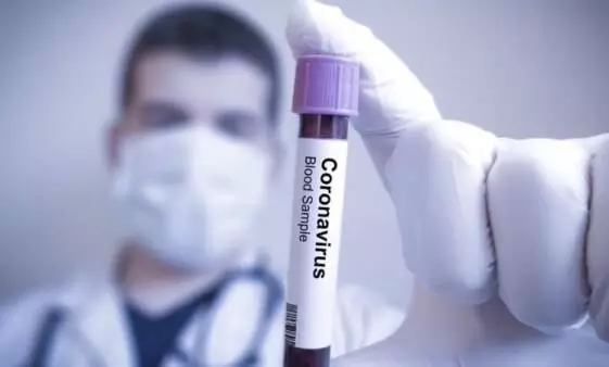 കോവിഡ്: കോഴിക്കോട്ട് അഞ്ചു പേർ കൂടി മരിച്ചു കോവിഡ്: കോഴിക്കോട്ട് അഞ്ചു പേർ കൂടി മരിച്ചു