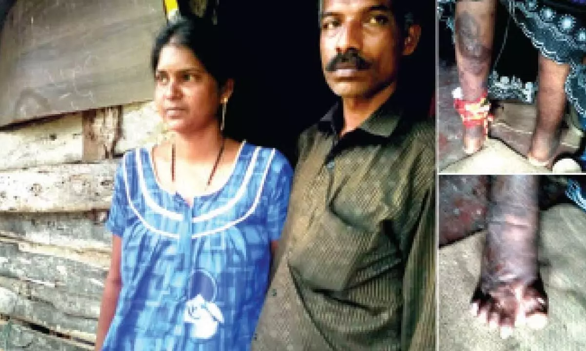 ദുരിതം നൽകി അപൂർവരോഗം; യുവതി സഹായം തേടുന്നു