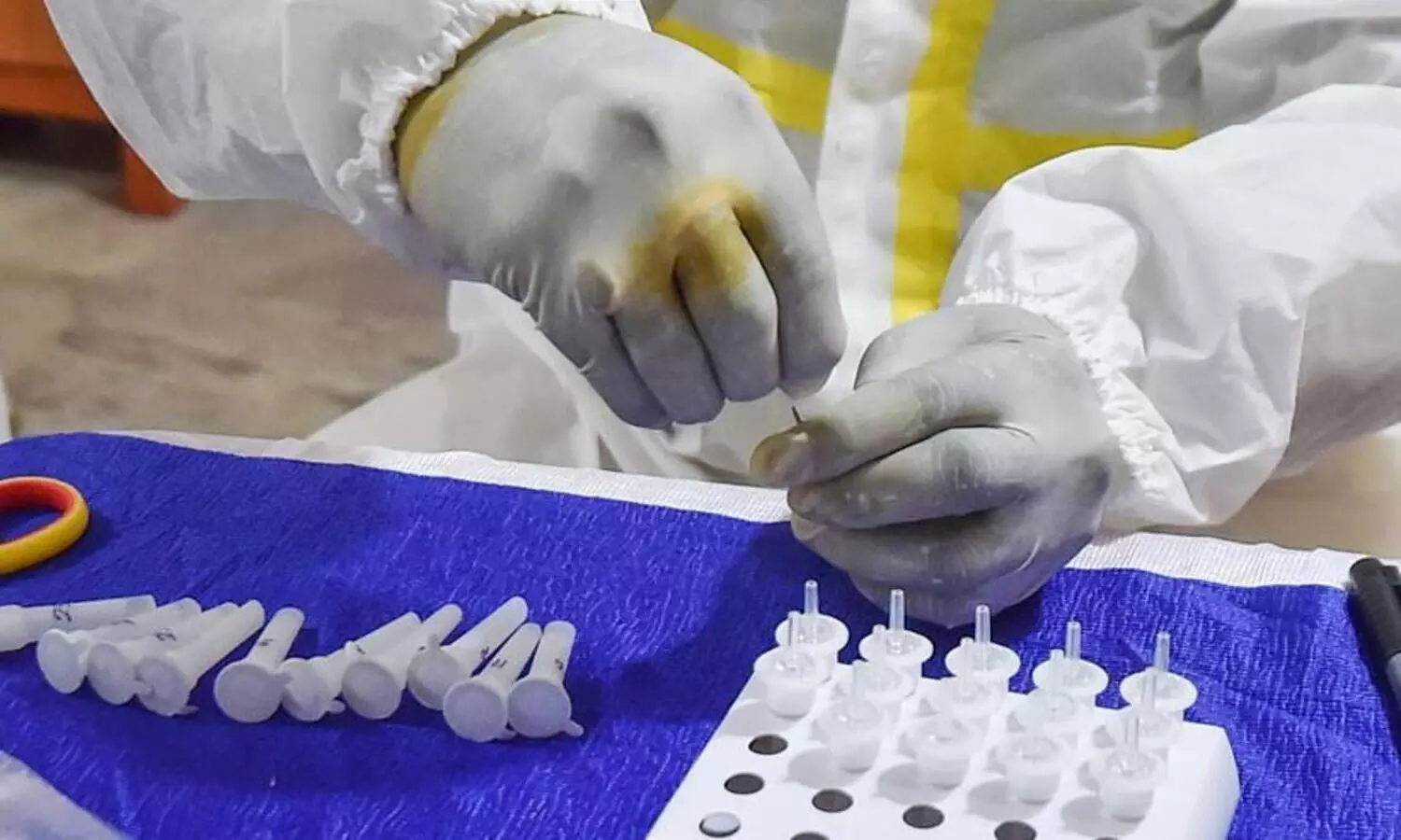 സംസ്​ഥാനത്ത്​ വീണ്ടും കോവിഡ്​ മരണം; മരിച്ചത്​ വയനാട്​ സ്വദേശി