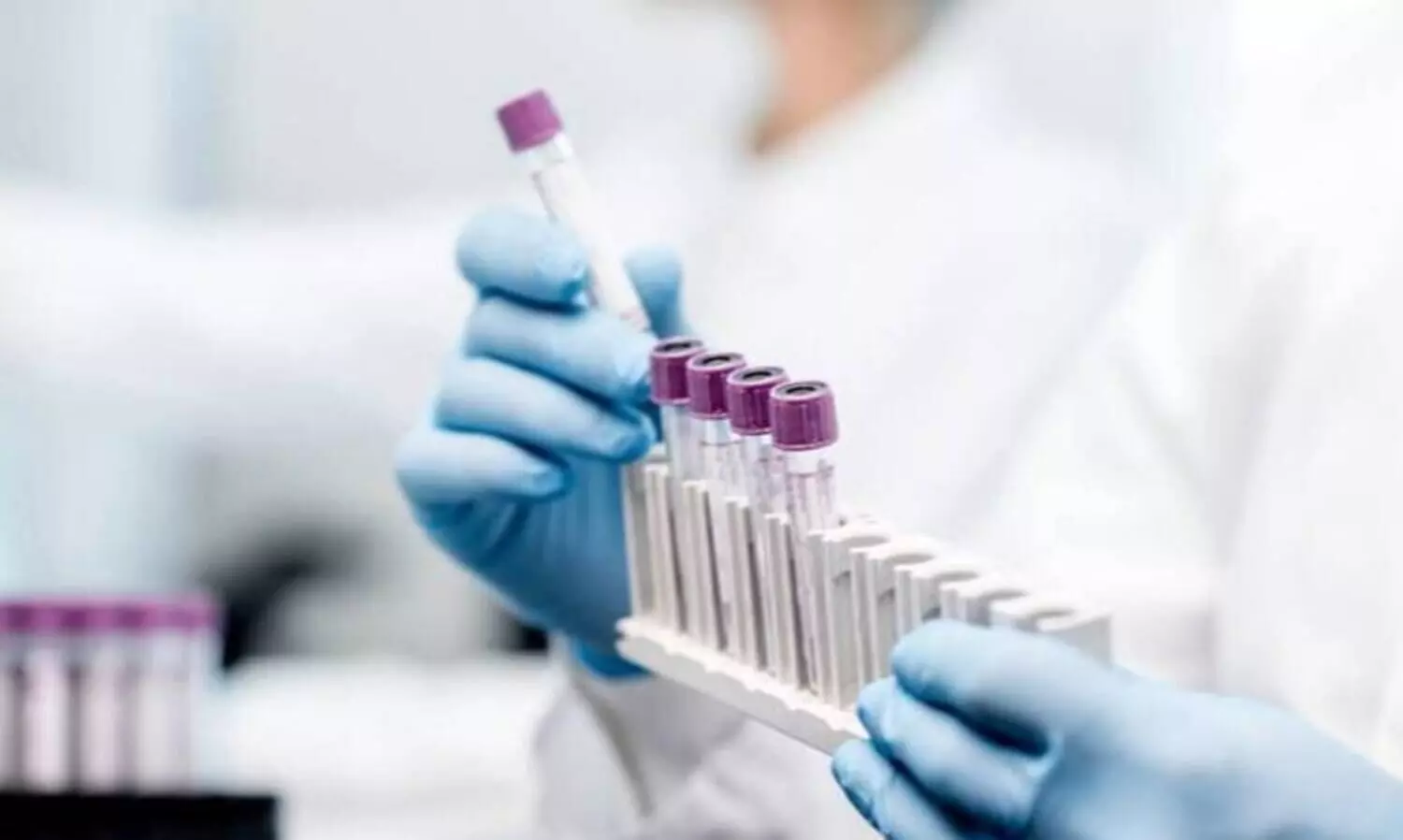 കോവിഡ്​: സൗദി അറേബ്യയിൽ 30 മരണവും 1185 രോഗമുക്തിയും