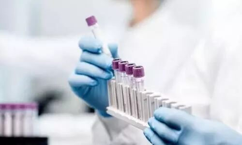 ആലപ്പുഴ നഗരസഭ വൈസ്​ ചെയർപേഴ്​സനും രണ്ടു സ്​ഥിരം സമിതി അധ്യക്ഷൻമാർക്കും കോവിഡ്​