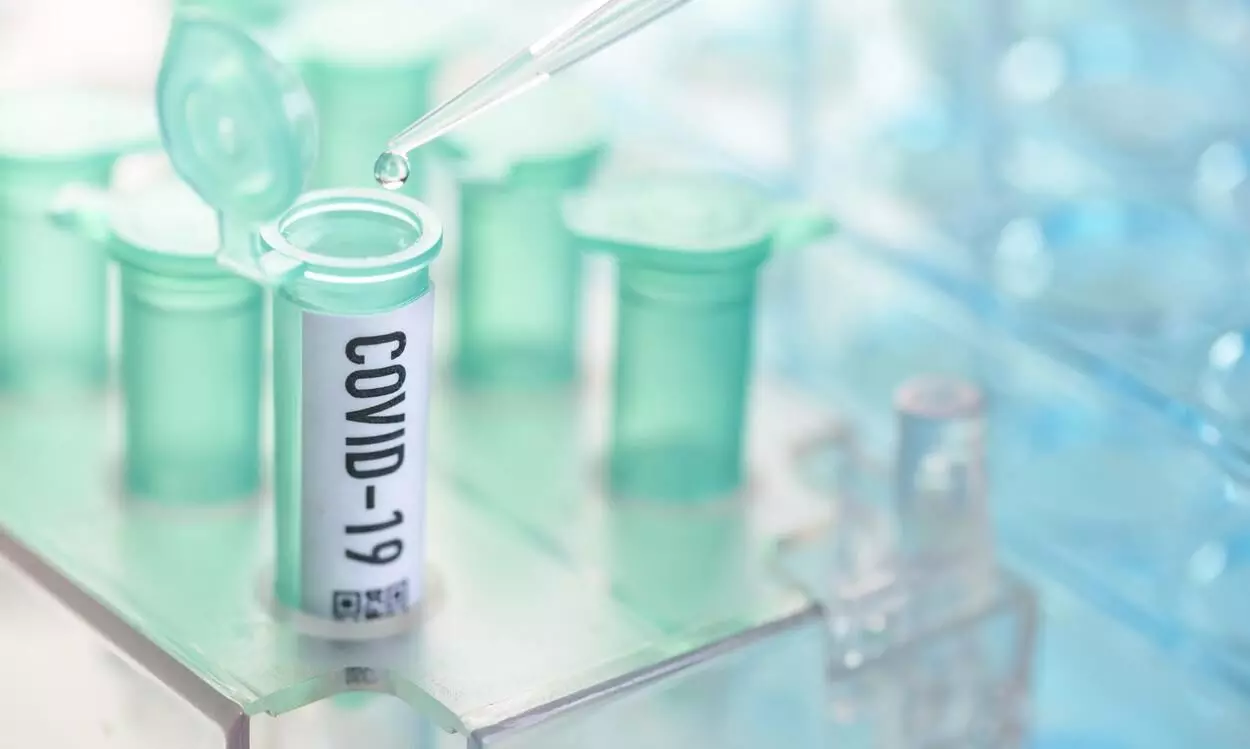 രണ്ടര കോടി കോവിഡ് രോഗികൾ; ആഗോള വ്യാപനം അതിവേഗം രണ്ടര കോടി കോവിഡ് രോഗികൾ; ആഗോള വ്യാപനം അതിവേഗം