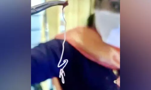 യുവതിയുടെ കണ്ണിൽ 20 സെ.മി നീളമുള്ള വിര യുവതിയുടെ കണ്ണിൽ 20 സെ.മി നീളമുള്ള വിര