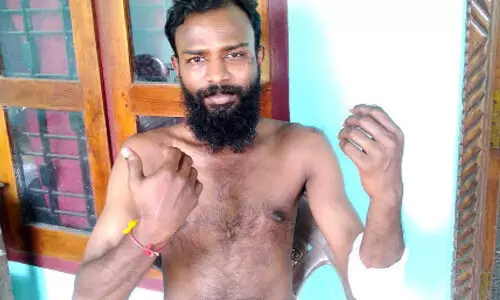 വ്യാ​പാ​രി​യെ കാ​ട്ടു​പ​ന്നി​ക്കൂ​ട്ടം ആ​ക്ര​മി​ച്ചു