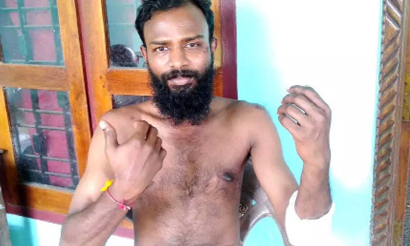 വ്യാ​പാ​രി​യെ കാ​ട്ടു​പ​ന്നി​ക്കൂ​ട്ടം ആ​ക്ര​മി​ച്ചു