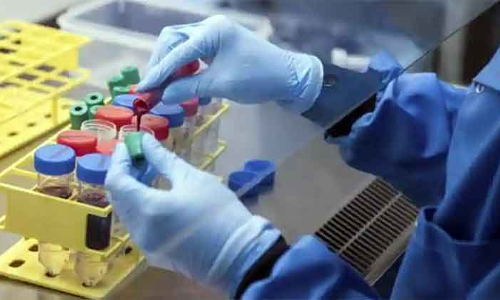 കോവിഡ്​: പുതിയ രോഗികൾ 243, രോഗമുക്​തർ 277