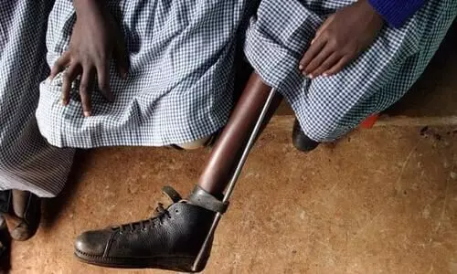 ദശാബ്​ദങ്ങൾ നീണ്ട കഠിനാധ്വാനം: ആഫ്രിക്ക പോളിയോ മുക്തമാകുന്നു