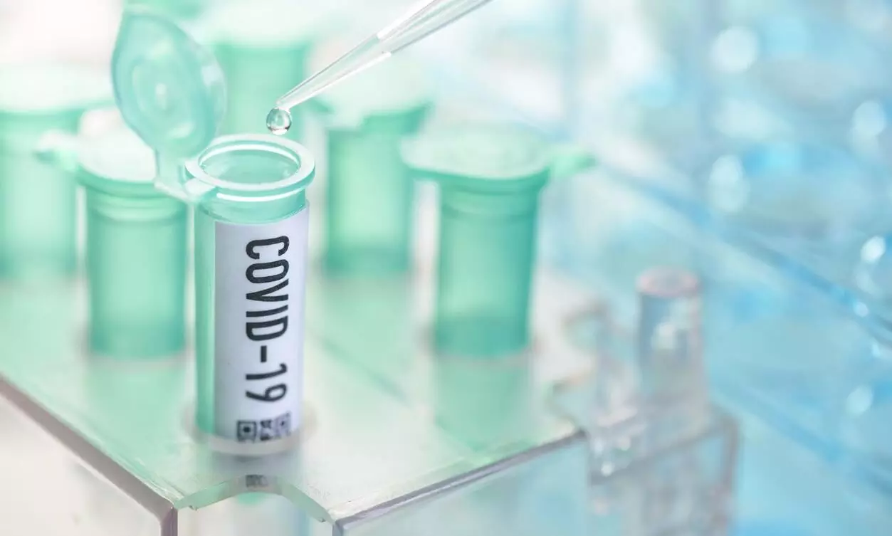 കോവിഡ്: സൗദി അറേബ്യയിൽ ചൊവ്വാഴ്ച 31 മരണവും 1114 പുതിയ രോഗികളും കോവിഡ്: സൗദി അറേബ്യയിൽ ചൊവ്വാഴ്ച 31 മരണവും 1114 പുതിയ രോഗികളും