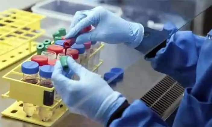 തലസ്ഥാനത്ത് കോവിഡ് തീവ്രവ്യാപന സാധ്യതയെന്ന് മുന്നറിയിപ്പ് തലസ്ഥാനത്ത് കോവിഡ് തീവ്രവ്യാപന സാധ്യതയെന്ന് മുന്നറിയിപ്പ്