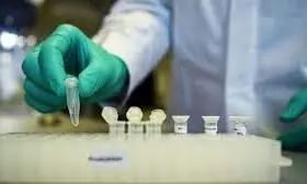 സംസ്ഥാനത്ത് ഇന്ന് 2406 പേർക്ക് കോവിഡ്; 2175 പേര്ക്ക് സമ്പര്ക്കത്തിലൂടെ രോഗം സംസ്ഥാനത്ത് ഇന്ന് 2406 പേർക്ക് കോവിഡ്; 2175 പേര്ക്ക് സമ്പര്ക്കത്തിലൂടെ രോഗം