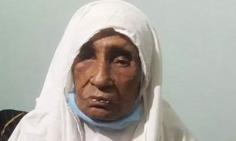 കോവിഡിനെ അതിജീവിച്ച് 110 കാരി: മഞ്ചേരി മെഡിക്കല് കോളേജിന് അഭിമാനം കോവിഡിനെ അതിജീവിച്ച് 110 കാരി: മഞ്ചേരി മെഡിക്കല് കോളേജിന് അഭിമാനം